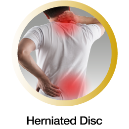 Herniated disc mobile