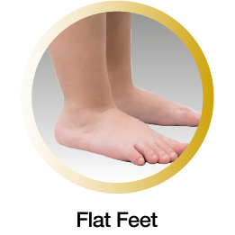 flat feet mobile