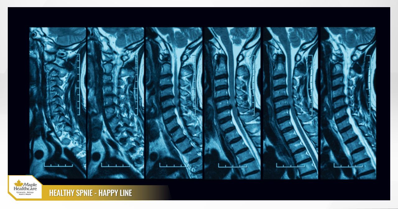 Magnetic Resonance Imaging