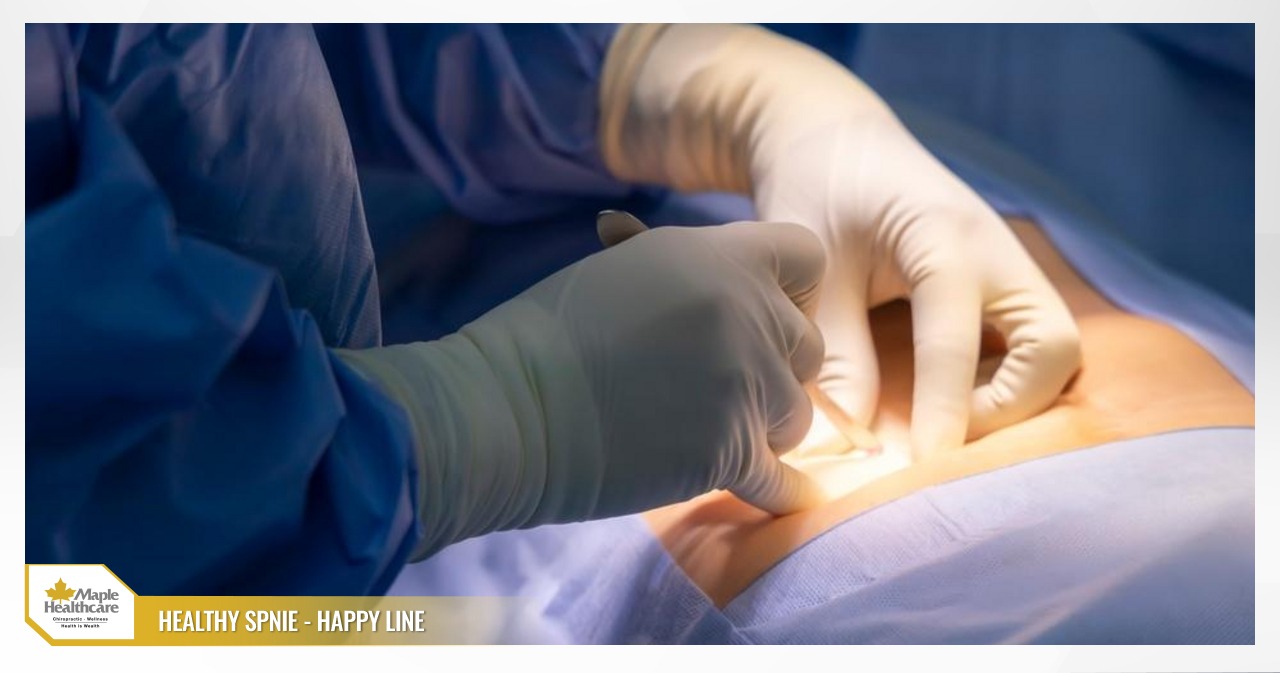 appendicitis