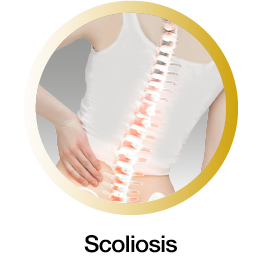 Scoliosis-mobile Scoliosis mobile