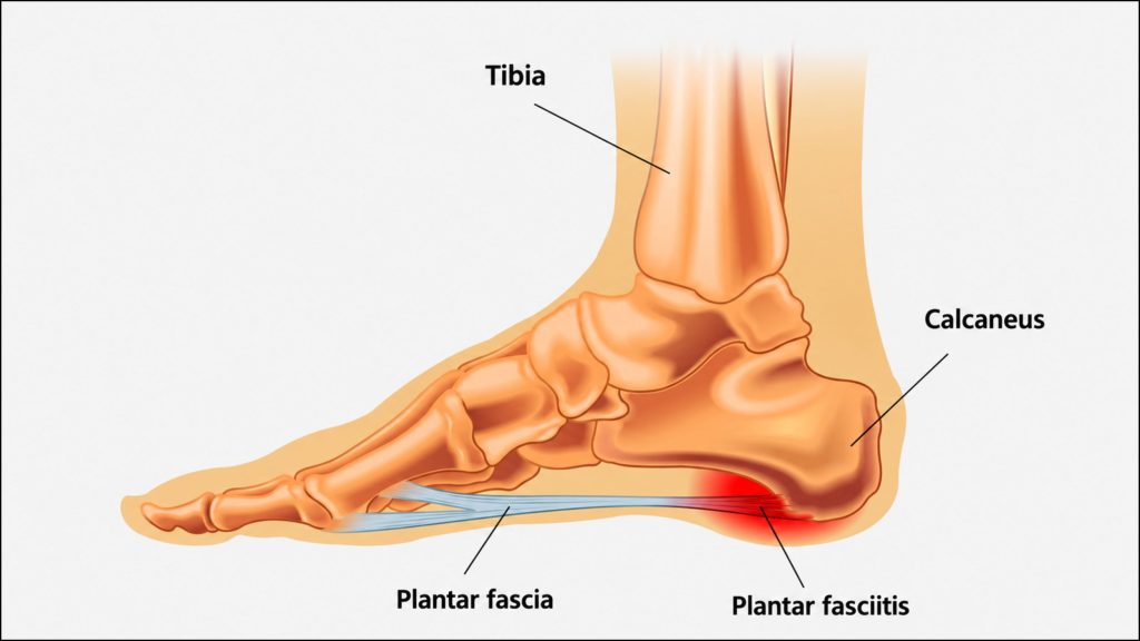 The plantar fascia is the thick band of connective tissue running